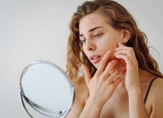 L’anxiété liée à la skincare : une problématique croissante chez les jeunes