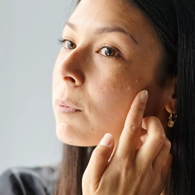 Whitening Perfect - galerie